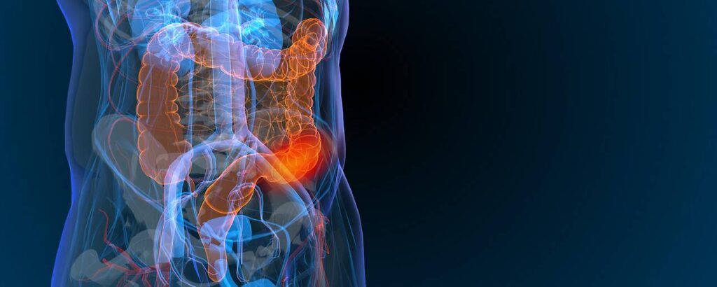 Darmkrebs: Neue Alternativen zur Koloskopie