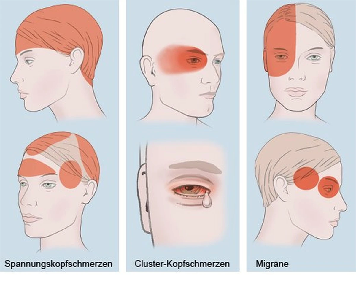 Schniefen oder Schnäuzen: Welche Methode schont Ihre Gesundheit am besten? - image 1